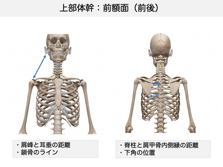 上部体幹アライメント評価：ポイントは三角形 | KONNICHIPT.COM